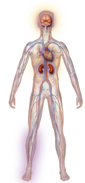 Type 2 diabetes